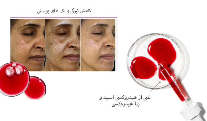 سرم لایه بردار پیلینگ تایم ویت ویتالایرحجم 30 میل