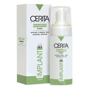 شامپو فوم موهای کاشته شده و پی آر پی